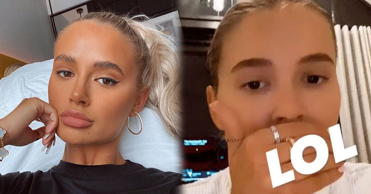 Molly Mae Hague Teases Natural Lips As She Has Fillers Completely Dissolved C103 