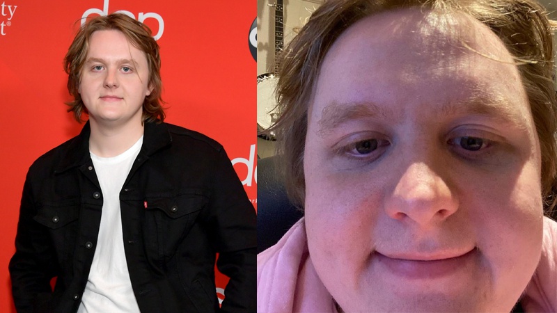 Lewis Capaldi (@LewisCapaldi) / X