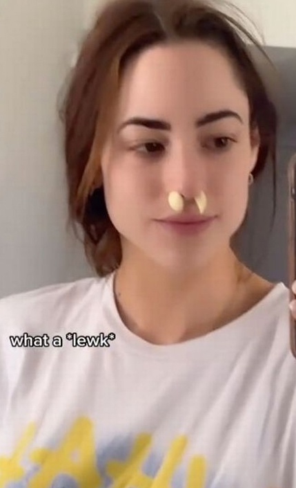 Doctors Warn Against Tiktok Trend That Sees Users Stuff Garlic Up Their 0211