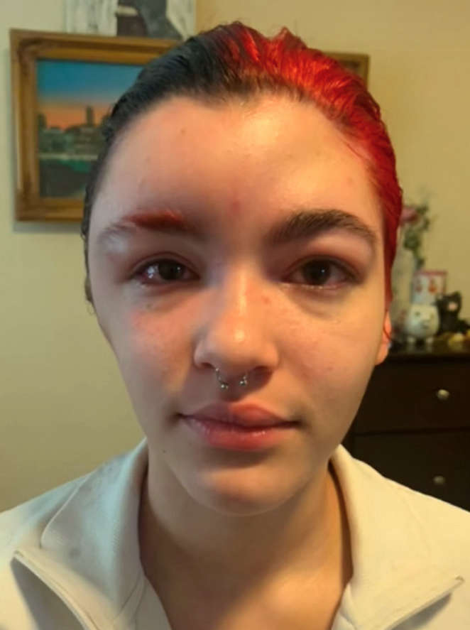 Watch Woman Shares Photo Terrifying Reaction To Hair Dye Dublin S Fm104