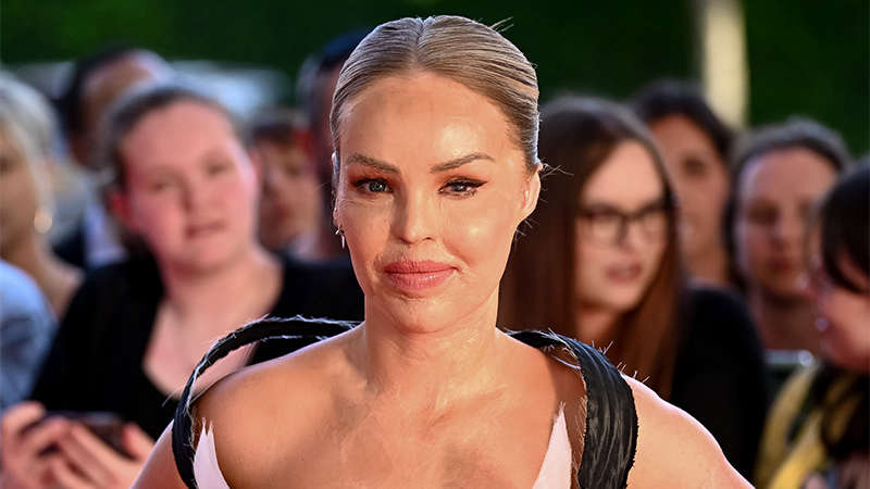 Katie Piper undergoes surgery to avoid losing left eye