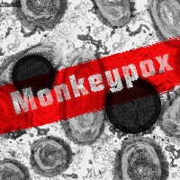 Five things we're googling about Monkeypox